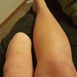 amputeeash leaked from onlyfans