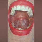 tiny_uvula leaked from onlyfans