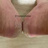 crustywonkytoes leaked from onlyfans